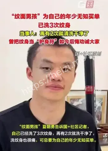 纹面男孩洗纹身经历